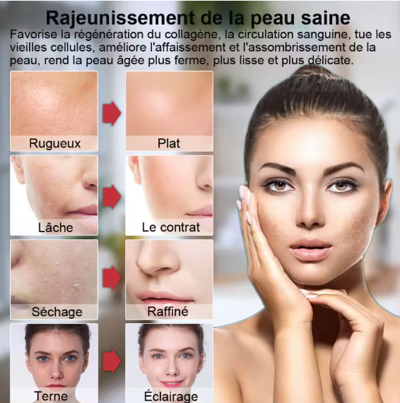 Masseur faciale RF - Lifting Anti-âge visage et bras